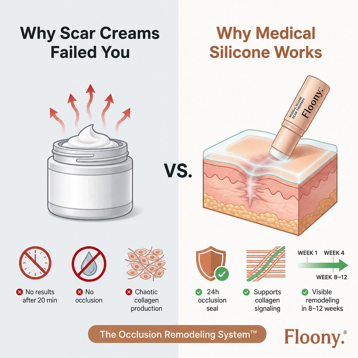 Before and after acne scar improvement with Floony